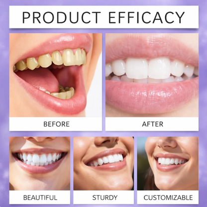 Aurven Pearl™ Whitening Strips